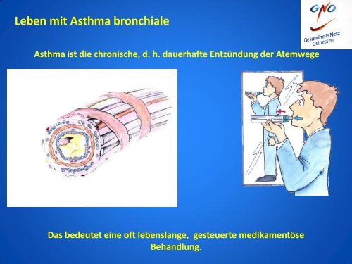 Rolle der Allergene bei Asthma - Gesundheitsnetz Osthessen