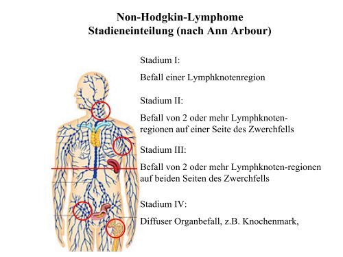 Maligne Lymphome - Tumorzentrum Bonn eV