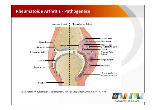 UPDATE Rheumatologie Voglmayr_komprimiert - TurnusDoc