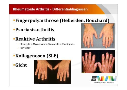 UPDATE Rheumatologie Voglmayr_komprimiert - TurnusDoc