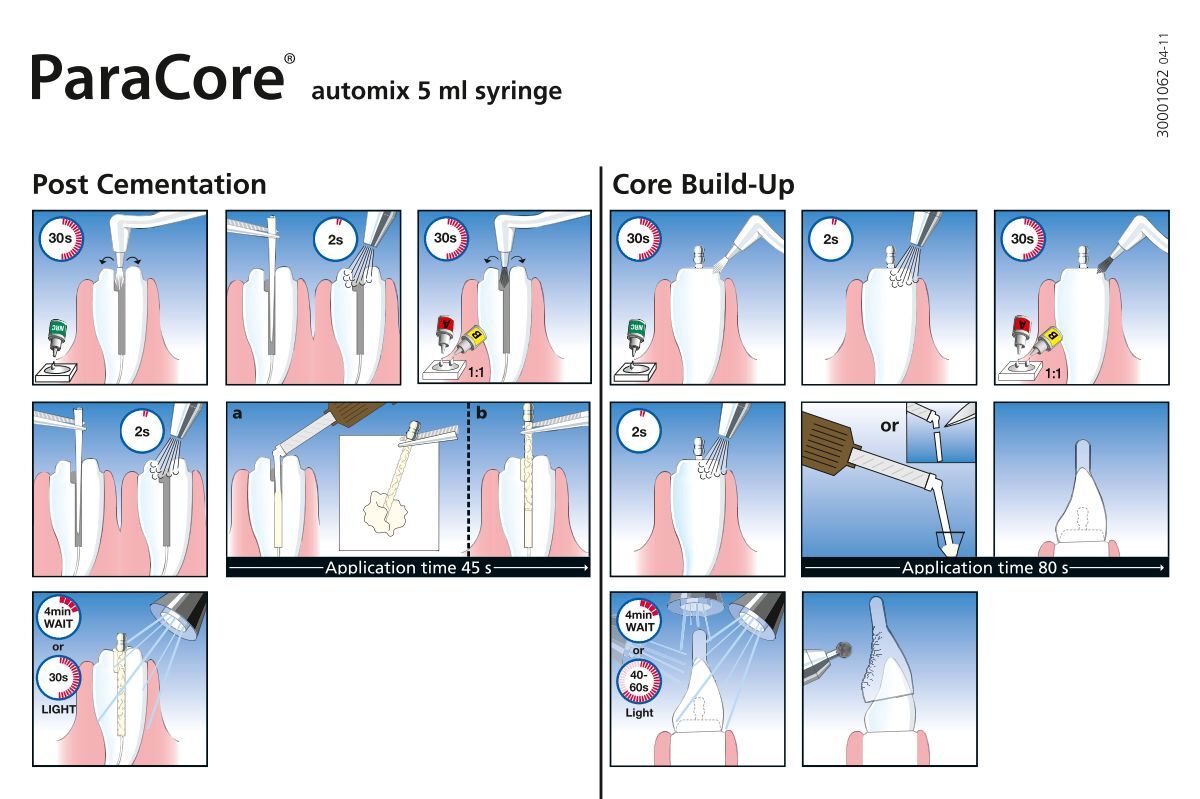 Post and Core Build-Up in One Step - MEDIPRO