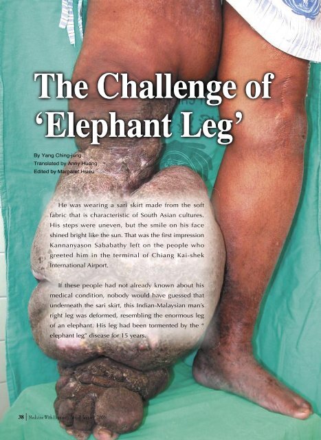 Elephant Leg