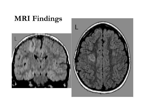 Understanding Electroencephalography - University of Arkansas for ...