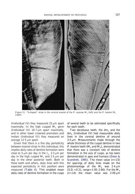 Comparative dental development and microstructure of ... - UCL