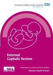 External Cephalic Version - University College London Hospitals