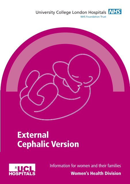 External Cephalic Version - University College London Hospitals