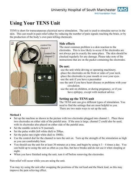 TENS (transcutaneous electrical nerve stimulation) - NHS