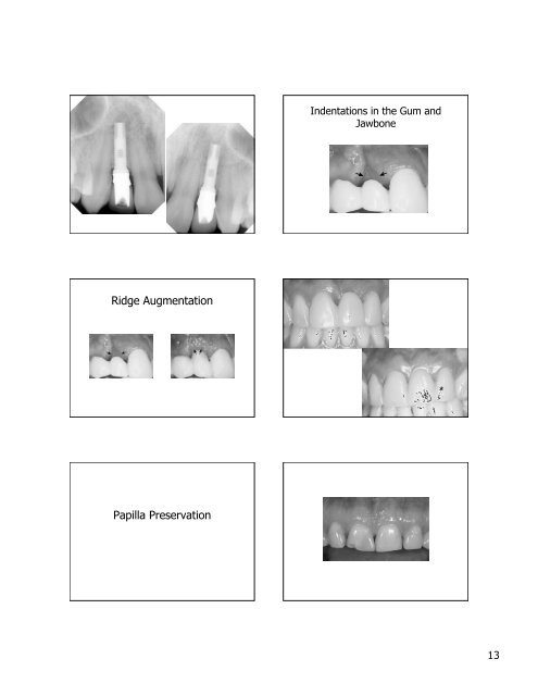 Periodontal Plastic Surgery To view this in Powerpoint click on the ...