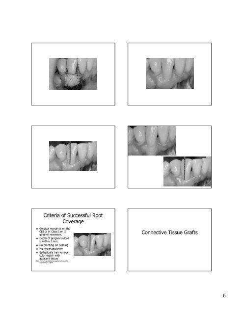 Periodontal Plastic Surgery To view this in Powerpoint click on the ...