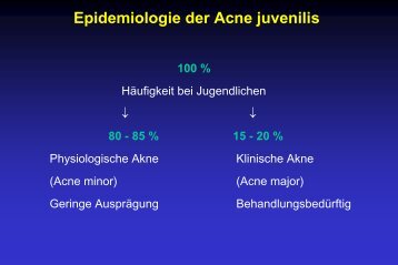 Epidemiologie der Acne juvenilis