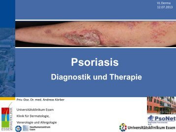 Psoriasis II - UniversitÃ¤tsklinikum Essen