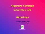 Allgemeine Pathologie Schnittkurs AP8 Metastasen