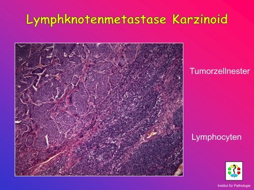 Allgemeine Pathologie Schnittkurs AP8 Metastasen