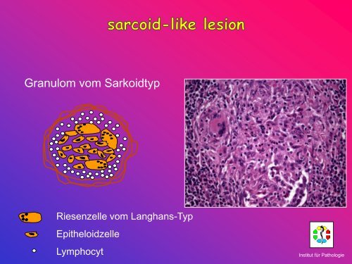 Allgemeine Pathologie Schnittkurs AP8 Metastasen