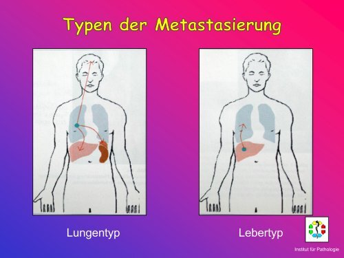 Allgemeine Pathologie Schnittkurs AP8 Metastasen