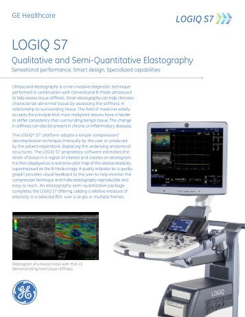 GE Logiq S7 Elastography - BCF Technology