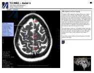 T2 MRI Axial: Interactive Clinical Neuroanatomy Atlas