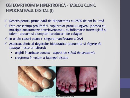 OSTEOARTROPATIA HIPERTROFICĂ