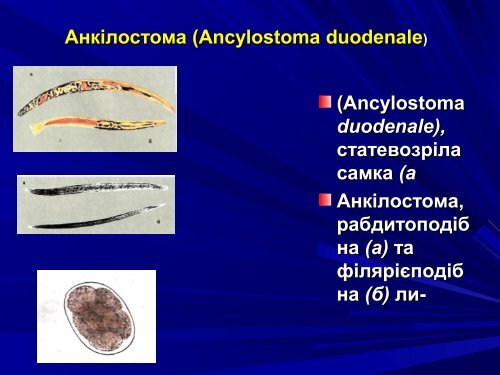 Медична гельмінтологія.Плоскі черви –паразити людини.