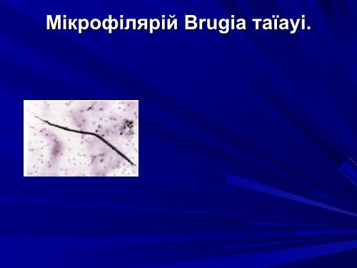 Медична гельмінтологія.Плоскі черви –паразити людини.