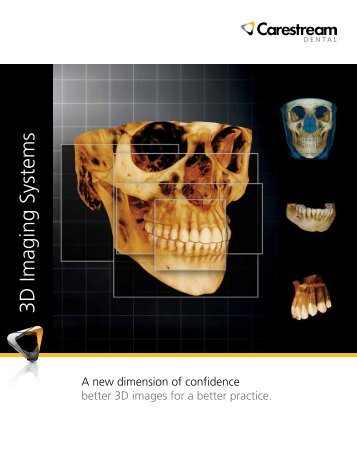 3D Imaging Systems - Dentalmind