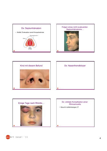 Blickdiagnosen HNO Prof. D. Bodmer.pdf - Universitätsspital Basel