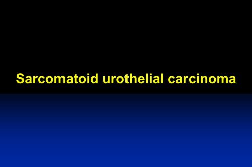 UROTHELIAL CARCINOMA