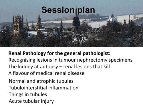 UROTHELIAL CARCINOMA