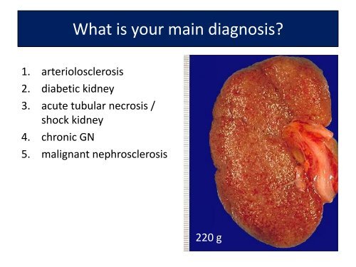 UROTHELIAL CARCINOMA