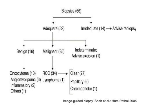 UROTHELIAL CARCINOMA