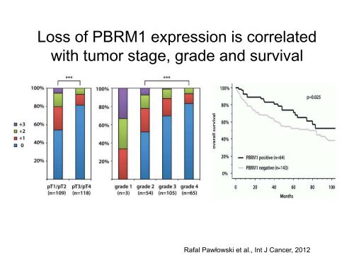 UROTHELIAL CARCINOMA