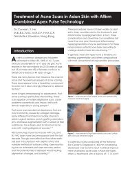 Treatment of Acne Scars in Asian Skin with Affirm Combined Apex ...