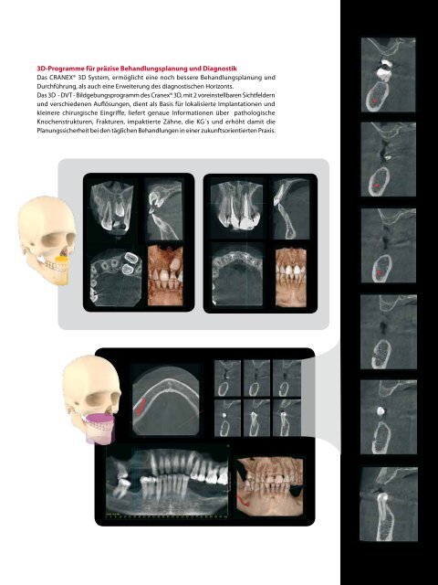 cranex® 3d - Soredex