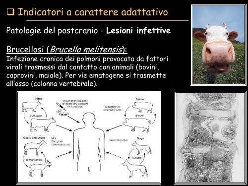 paleopatologia di popolazione - UniversitÃ  degli Studi della Tuscia