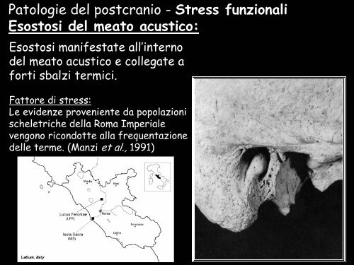 paleopatologia di popolazione - UniversitÃ  degli Studi della Tuscia