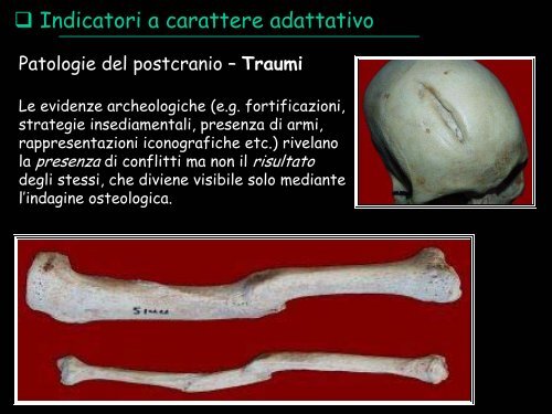 paleopatologia di popolazione - UniversitÃ  degli Studi della Tuscia