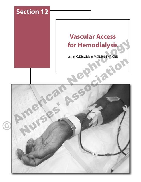 Section 12 Vascular Access for Hemodialysis - American ...