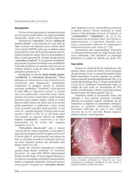 Durerea vulvara cronica. Prezentare de caz clinic