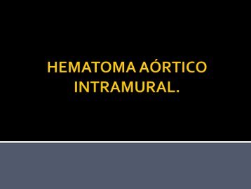 hematoma aórtico intramural: diagnostico mediante tc.