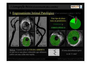 IVUS SERAM 4 - 30 Congreso de la SERAM. A Coruña. Mayo 2010.