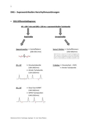 EKG â SupraventrikulÃ¤re HerzrhythmusstÃ¶rungen - Medizin 2