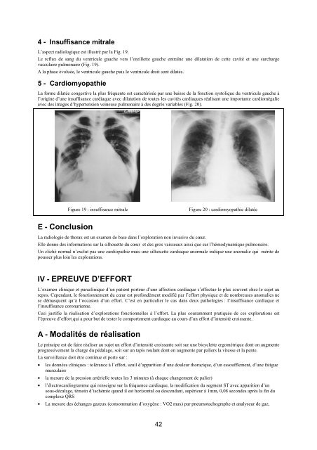 Semiologie Cardiologique compressÃ©