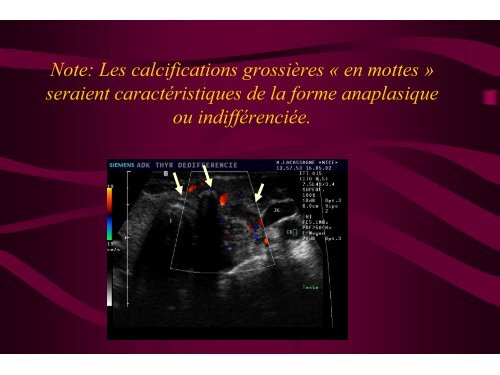 Pathologie Incidence Du
