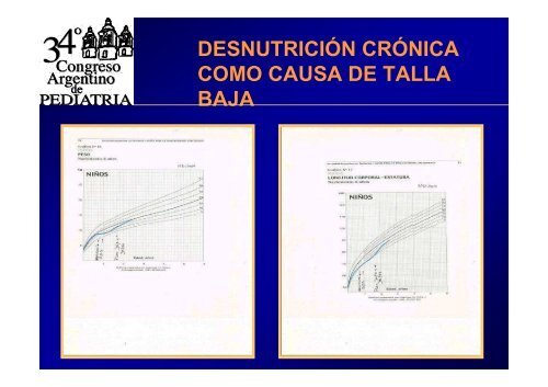 TALLA BAJA