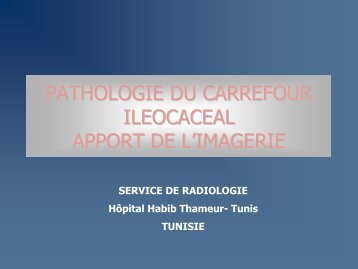 pathologie du carrefour ileocaceal apport de l'imagerie