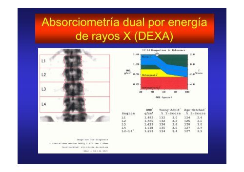 seguridad y efectos adversos en corticoides inhalados