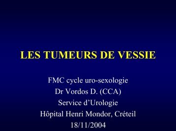 LES TUMEURS DE VESSIE - Service d'Urologie CHU Henri Mondor