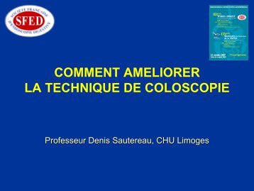 Comment amÃ©liorer la technique de coloscopie - SFED