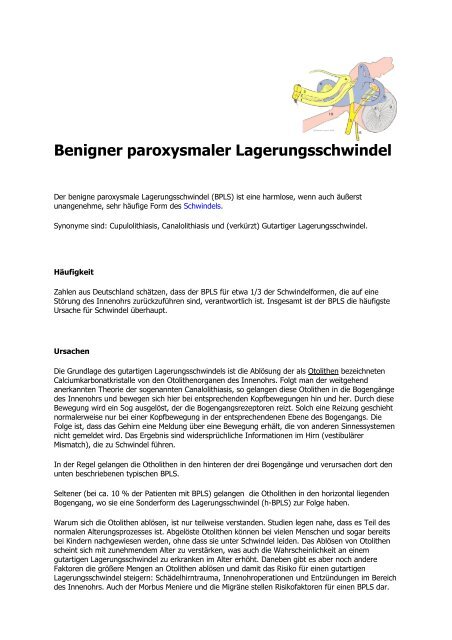 Benigner paroxysmaler Lagerungsschwindel - Gemeinschaftspraxis ...