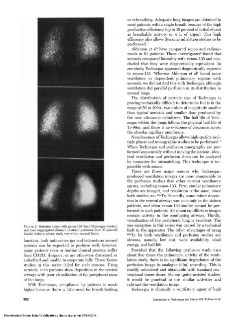 A Clinical Comparison of Technegas and Xenon-133 in 50 Patients ...